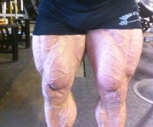 Another BRUTAL Leg Session Caught on Video 