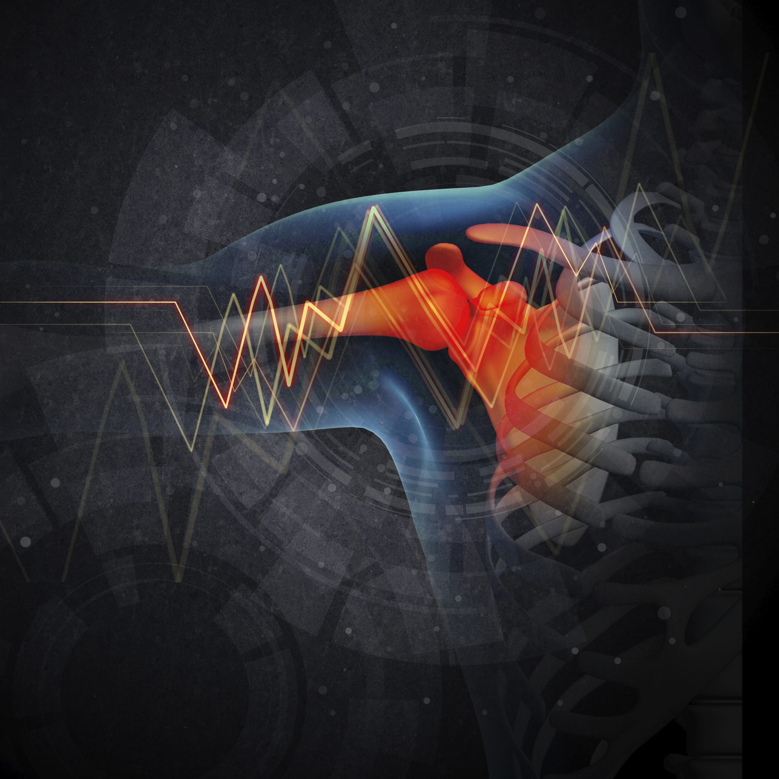 Why Powerlifters Should Train Their Shoulders