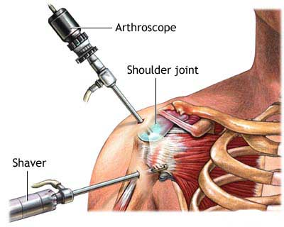 Post Surgery Update w/ Rehab Protocol .PDF