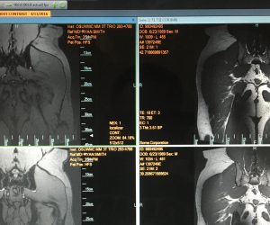 Appointment with Hip Specialist / Future Hip Replacement? / & the Return to Competing Raw