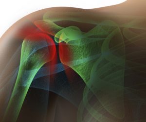 Sensory Awareness: Rotator Cuff Activation 