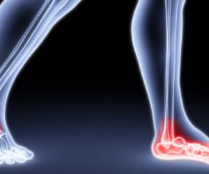 Build Your Arch: Why Flat Feet Kill Your Squat