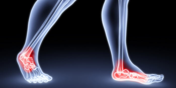 Build Your Arch: Why Flat Feet Kill Your Squat