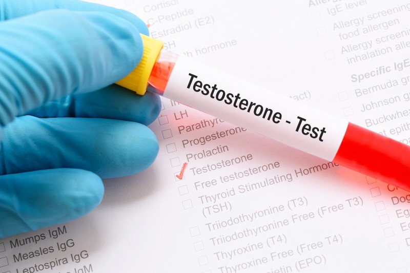 Testosterone test
