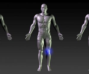 ACL Rehab Phase One — Returning to the Weight Room