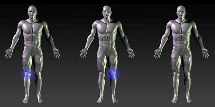 ACL Rehab Phase One — Returning to the Weight Room