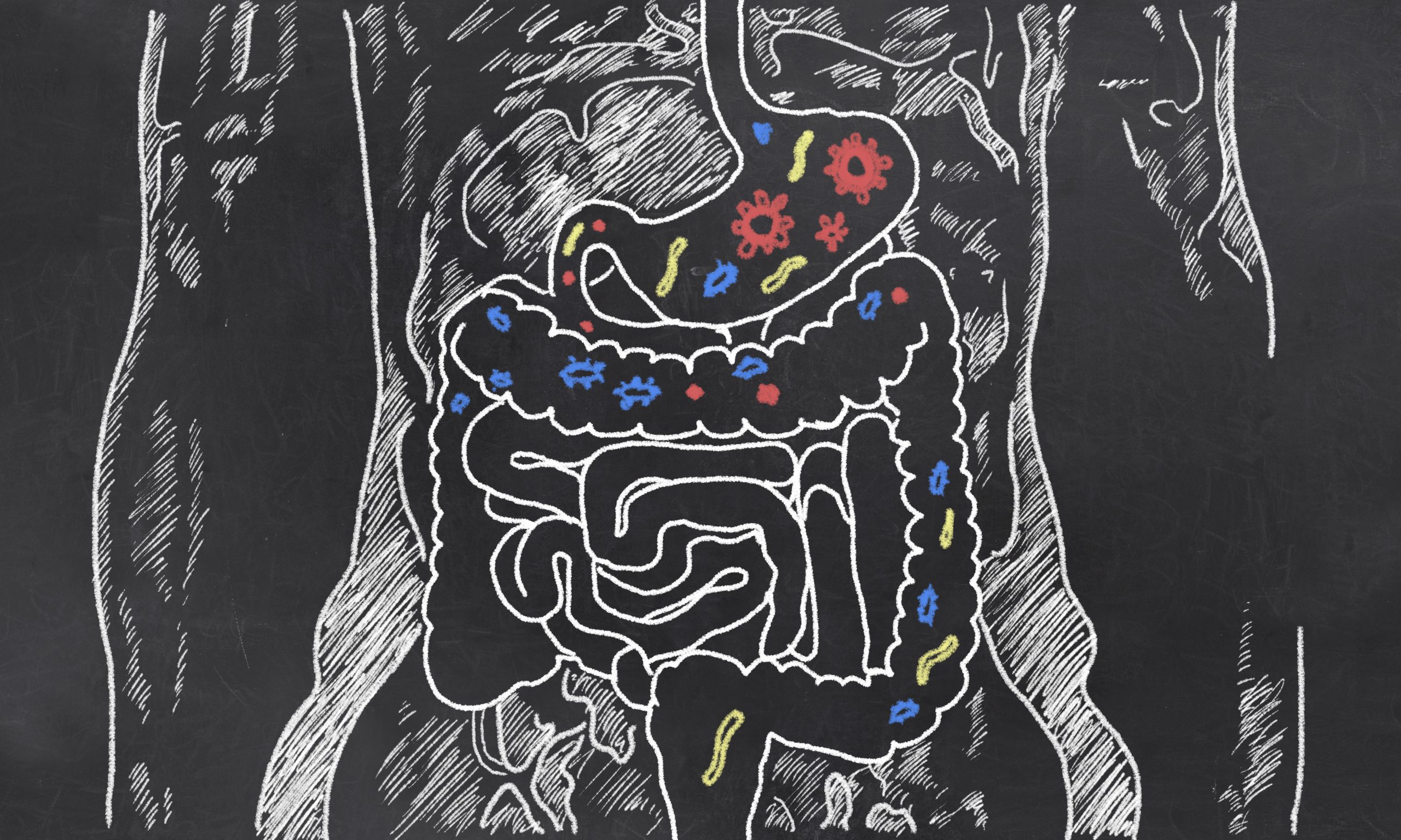 Upper GI Bleeding