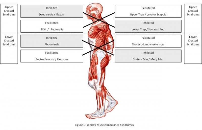 JandaSyndromes