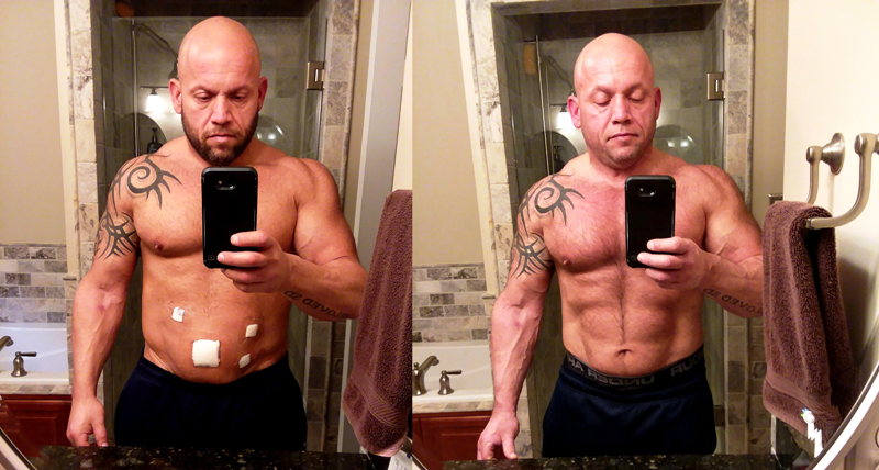 Weakened After His Twin Hernia Surgeries, Bodybuilding 'Gift' Finally  Overcomes His Troubles With a New-Found Exercise at Age 43 -  EssentiallySports