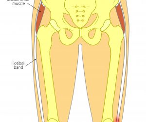 Temporarily Alleviate or Troubleshoot HIP SHIFT