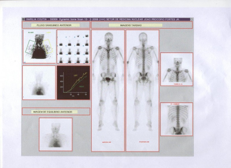 cintilografia